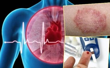 Contraindicaciones para el lipolifting