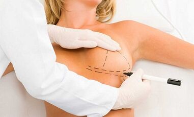 Cómo aumentar los cerebrales de los implantes