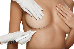 Marcar con un marcador antes de la cirugía de aumento de senos